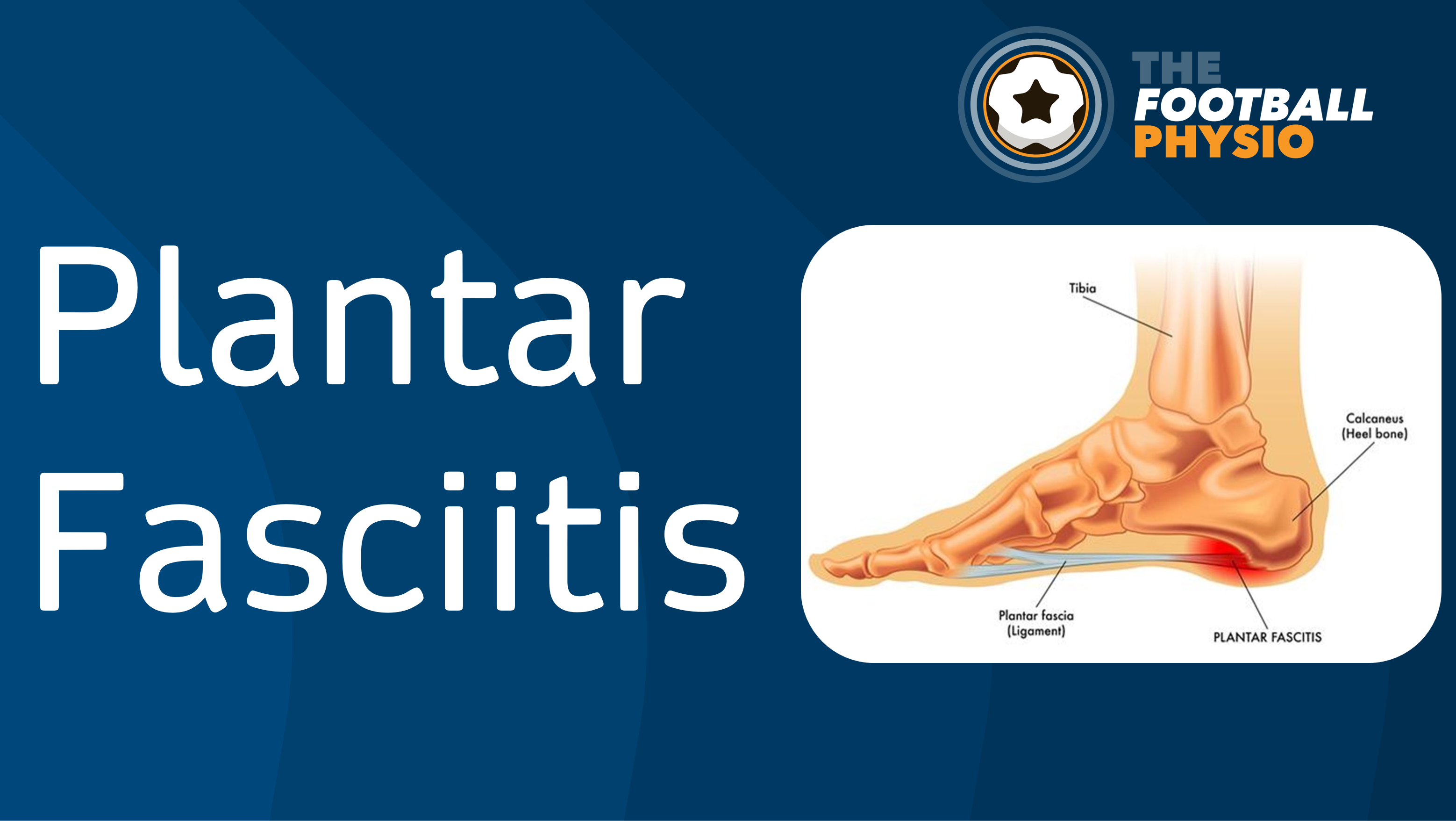Plantar Fasciitis in Football Players The Football Physio